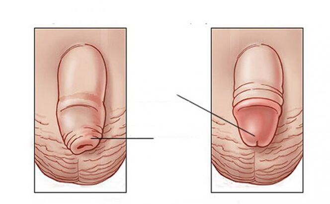 Qué actividad lleva a cabo el lubricante