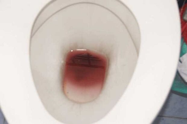 avistamiento en hombres cuando están excitados